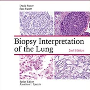 Biopsy Interpretation Of The Lung 2Ed Hb 2021