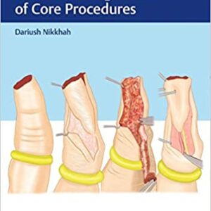 Hand Trauma Illustrated Surgical Guide Of Core Procedures Hb 2018