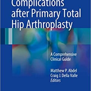 Complications Agter Primary Total Hip Arthroplasty A Comprehensive Clinical Guide Hb 2017
