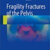 9783319665702 | Fragility Fractures Of The Pelvis Hb 2017 | 9783319666518 | Together Books Distributor