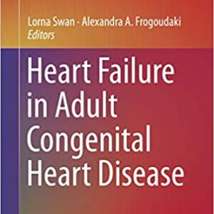 Heart Failure In Adult Congenital Heart Disease Hb 2018