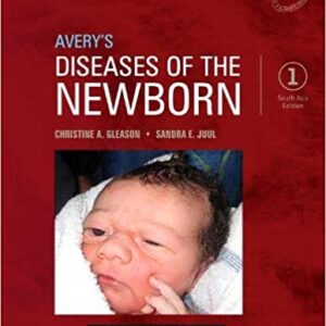 Avery’S Diseases Of The Newbornsae 1E