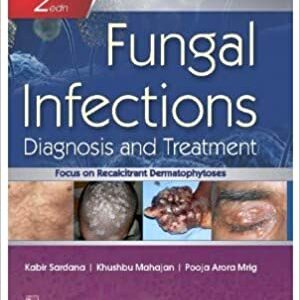 Fungal Infections Diagnosis And Treatment 2Ed Hb 2021