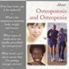 9780763738549 1 | 100 Questions & Answers About Osteoporosis And Osteopenia | 9781107027992 | Together Books Distributor