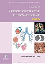 An Atlas Of Chronic Obstructive Pulmonary Disease Encyclopaedia Of Visual Medicine Series