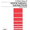 9781850707172 1 | A Slide Atlas Of Myocardial Infarction (Encyclopedia Of Visual Medic | 9781850709039 | Together Books Distributor