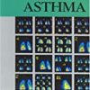 9781850709084 1 | An Atlas Of Asthma Encyclopedia Of Visual Medicine Encyclopedia Of Visual Medicine Series | 9781850709305 | Together Books Distributor