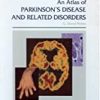 9781850709435 1 | An Atlas Of Parkinson'S Disease And Related Disorders Encyclopedia Of Visual Medicine Series | 9781857758979 | Together Books Distributor