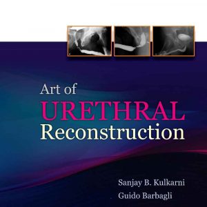Art Of Urethral Reconstruction