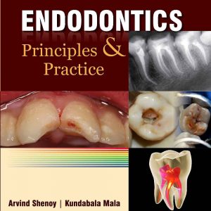 Endodontics: Principles And Practice