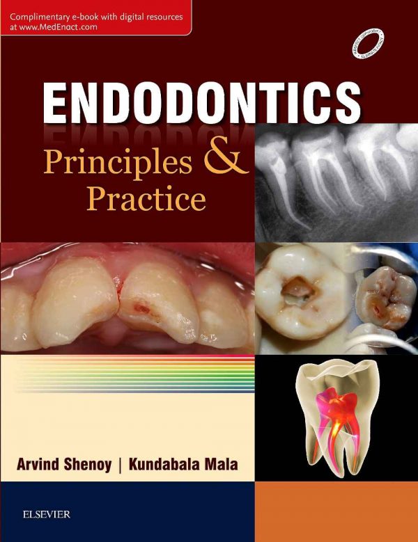 9788131244487 1 | Endodontics: Principles and Practice | 9788131244487 | Together Books Distributor