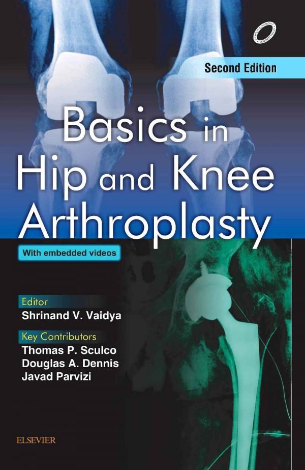 Basics In Hip And Knee Arthroplasty 2E