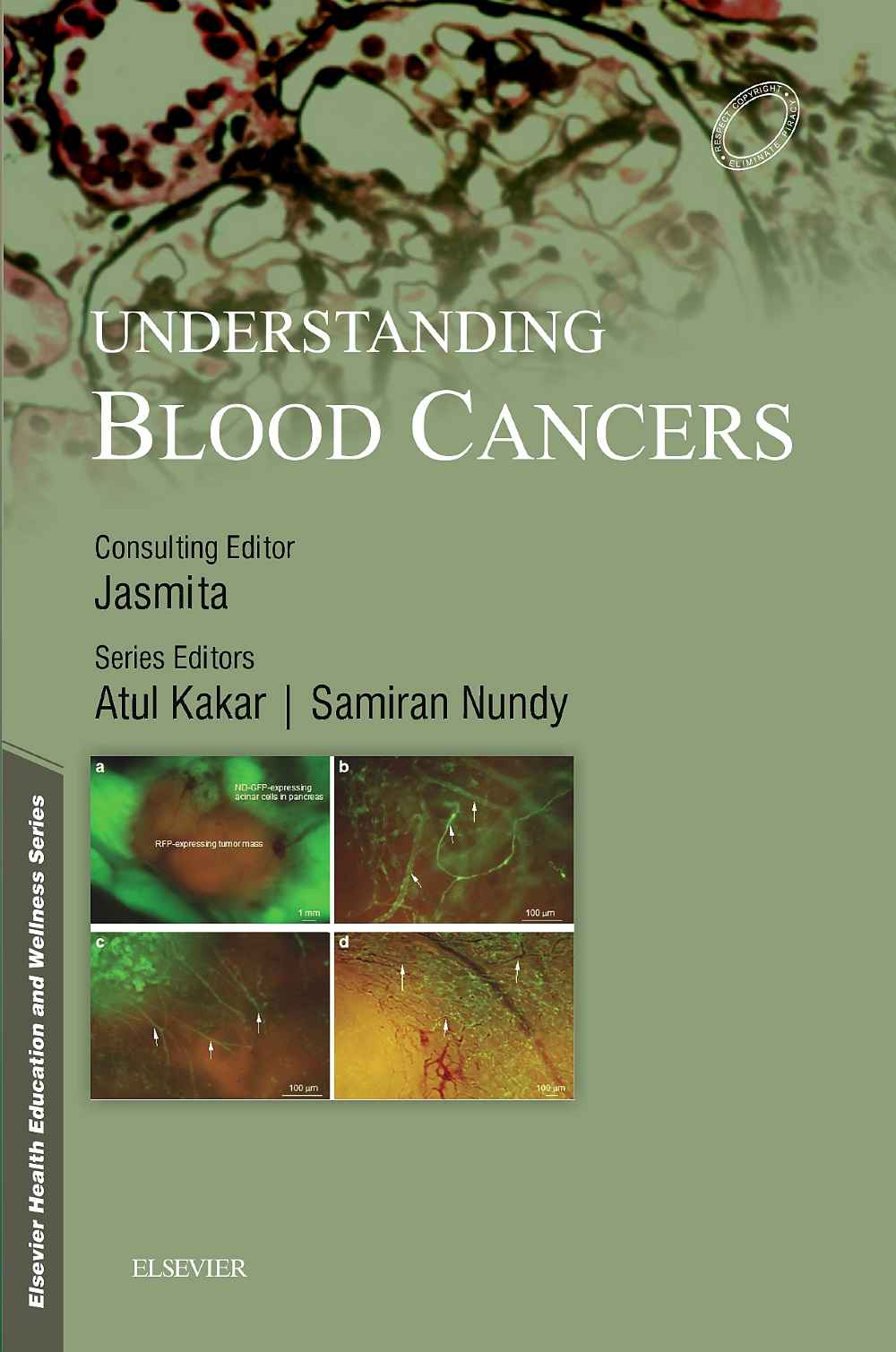 9788131249758 1 | Understanding Blood Cancers 1E | 9788131249758 | Together Books Distributor Understanding Blood Cancers 1E