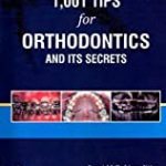 1001 Tips For Orthodontics And Its Secrets