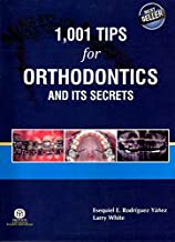 1001 Tips For Orthodontics And Its Secrets