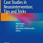 100 INTERESTING CASE STUDIES IN NEUROINTERVENTION TIPS AND TRICKS (HB 2019)