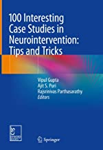 100 INTERESTING CASE STUDIES IN NEUROINTERVENTION TIPS AND TRICKS (HB 2019)