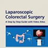 9780367352844 1 | Laparoscopic Colorectal Surgery A Step By Step Guide With Video Atlas Hb 2021 | 9780367492892 | Together Books Distributor