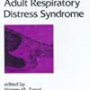 9780824783594 1 | ADULT RESPIRATORY DISTRESS SYNDROME | 9780891169048 | Together Books Distributor