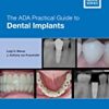 9781119630692 1 | The Ada Practical Guide To Dental Implants Pb 2021 | 9781119487579 | Together Books Distributor