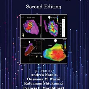 Handbook Of Cardiac Electrophysiology 2Ed Pb 2021
