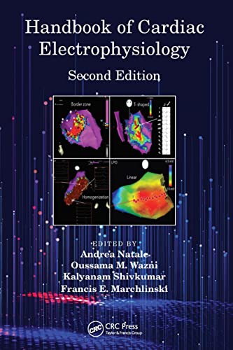 Handbook of Cardiac Electrophysiology 9781032242262